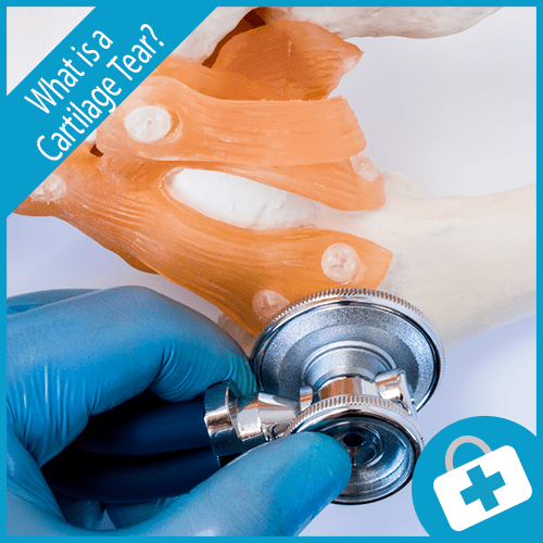 Cartilage Tear