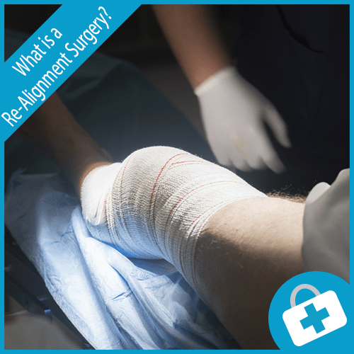 Re-alignment Surgery- How It Can Help