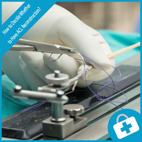 How to Decide Whether to Have ACL Reconstruction?