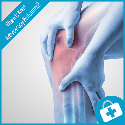 knee arthroscopy Cheshire expert