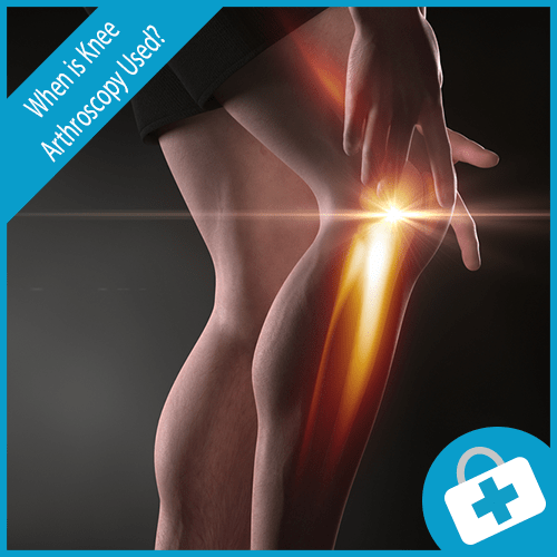 Knee Arthroscopy