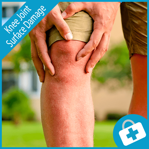 Knee Joint Surface Damage