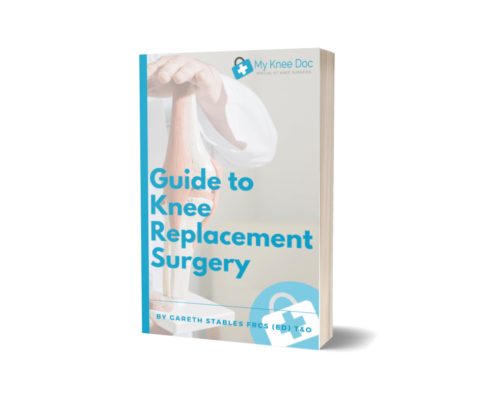 guide to knee replacement